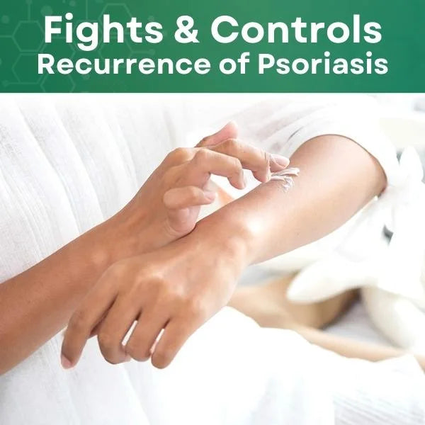 Psoriasis Treatment Cream (Orignal)